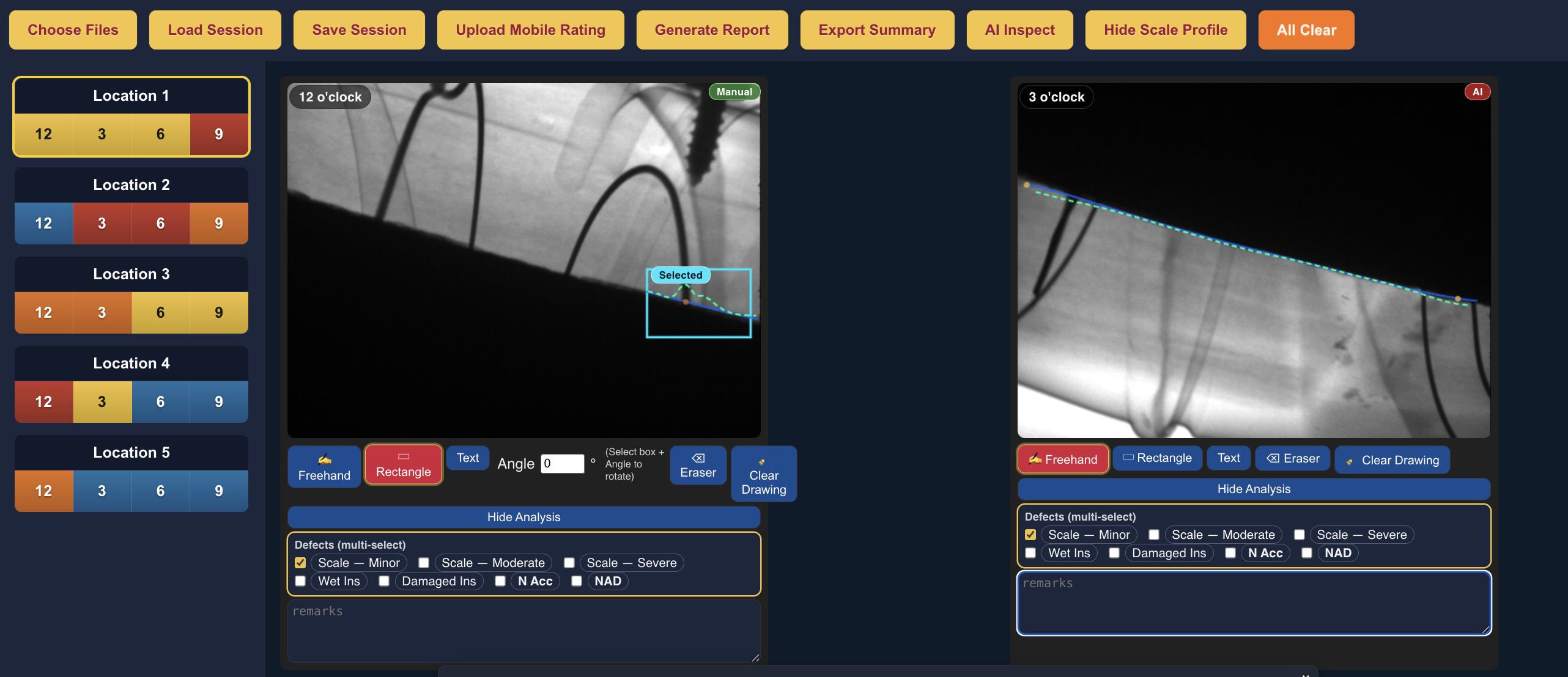 MasterRAID - Real-Time Radiography Interpretation Software